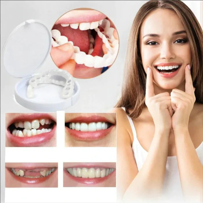 Carillas dentales Snap-On Smile™